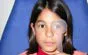 Visita oculistica pediatrica con valutazione ortottica