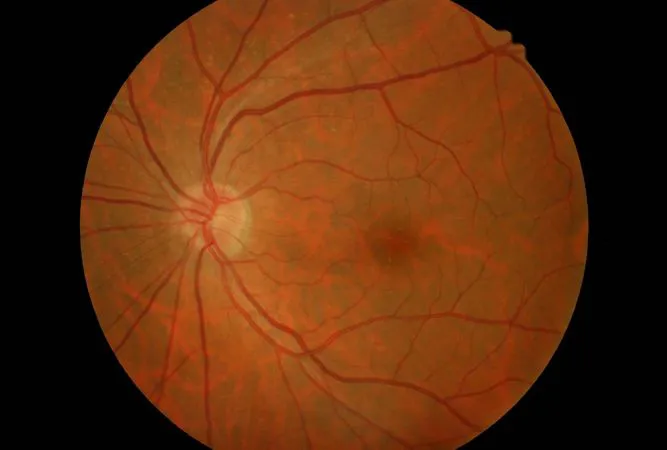 Esame del fondo oculare (fundus oculi)