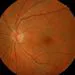Esame del fondo oculare (fundus oculi)