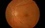 Esame del fondo oculare (fundus oculi)