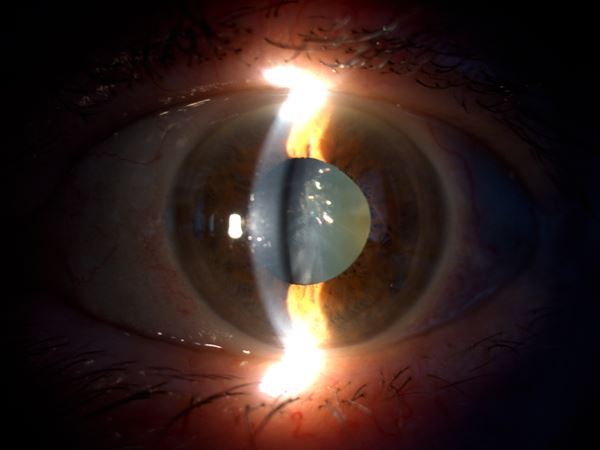 Foto del fundus (retinografia) e del segmento anteriore 