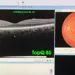 Esame OCT della retina e del nervo ottico